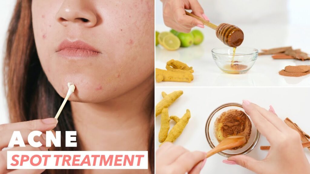Ayurvedic Acne Cream Manufacturers in India